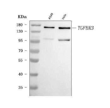 TGF beta Receptor III/TGFBR3 Rabbit Polyclonal Antibody