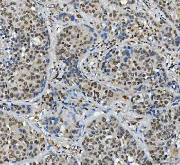 SFPQ Rabbit Polyclonal Antibody