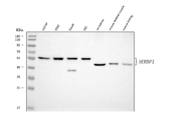 SERBP1 Rabbit Polyclonal Antibody
