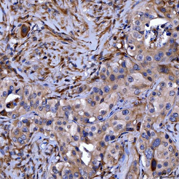 Septin 11/SEPTIN11 Rabbit Polyclonal Antibody