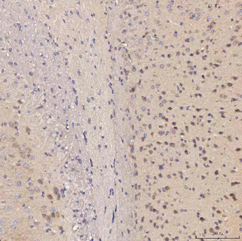 Septin 11/SEPTIN11 Rabbit Polyclonal Antibody