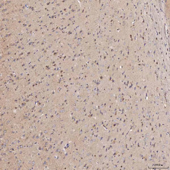 Septin 11/SEPTIN11 Rabbit Polyclonal Antibody