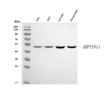 Septin 11/SEPTIN11 Rabbit Polyclonal Antibody