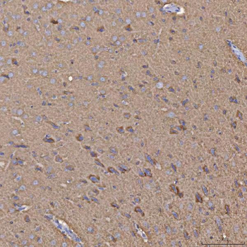 Selenophosphate synthetase 1/SEPHS1 Rabbit Polyclonal Antibody