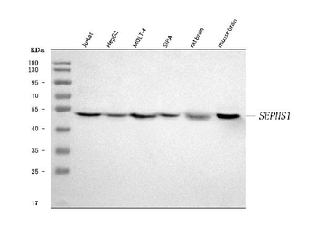 Selenophosphate synthetase 1/SEPHS1 Rabbit Polyclonal Antibody