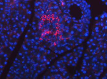 SEL1L Rabbit Polyclonal Antibody