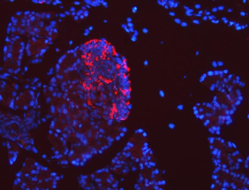 SEL1L Rabbit Polyclonal Antibody