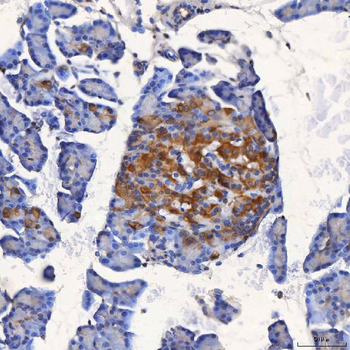 SEL1L Rabbit Polyclonal Antibody