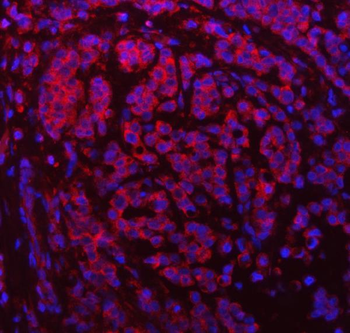 SDF2L1 Rabbit Polyclonal Antibody