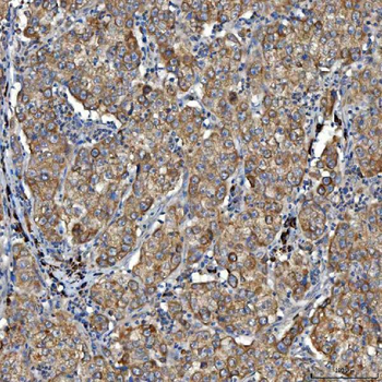 SDF2L1 Rabbit Polyclonal Antibody