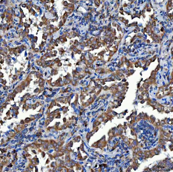 SDF2L1 Rabbit Polyclonal Antibody