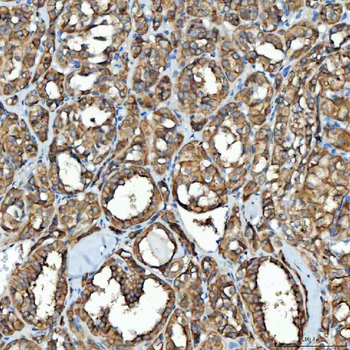 SDF2L1 Rabbit Polyclonal Antibody