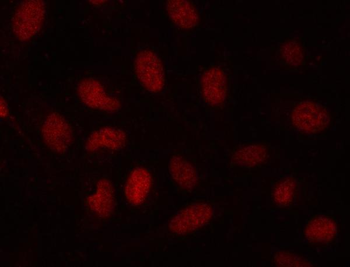 SDE2 Rabbit Polyclonal Antibody