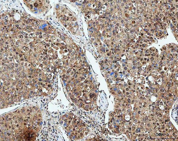 SDE2 Rabbit Polyclonal Antibody