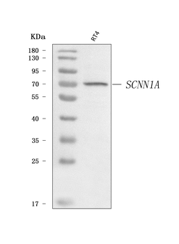 epithelial Sodium Channel alpha/SCNN1A Rabbit Polyclonal Antibody