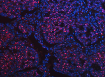 SCML1 Rabbit Polyclonal Antibody