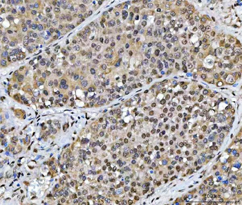 SCML1 Rabbit Polyclonal Antibody