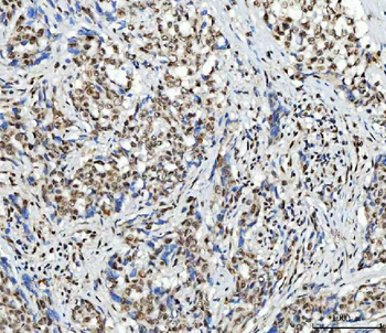 SCML1 Rabbit Polyclonal Antibody