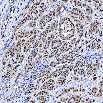 SCML1 Rabbit Polyclonal Antibody