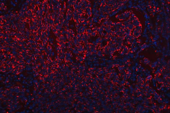 Scavenging Receptor SRB2/SCARB2 Rabbit Polyclonal Antibody
