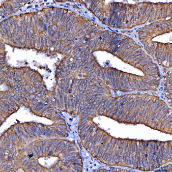 Scavenging Receptor SRB2/SCARB2 Rabbit Polyclonal Antibody