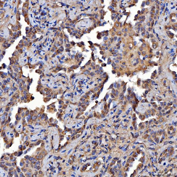 Scavenging Receptor SRB2/SCARB2 Rabbit Polyclonal Antibody