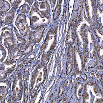 Scavenging Receptor SRB2/SCARB2 Rabbit Polyclonal Antibody