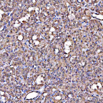 Scavenging Receptor SRB2/SCARB2 Rabbit Polyclonal Antibody