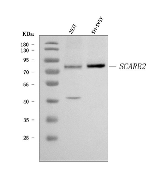 Scavenging Receptor SRB2/SCARB2 Rabbit Polyclonal Antibody