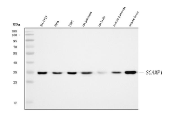 SCAMP1 Rabbit Polyclonal Antibody