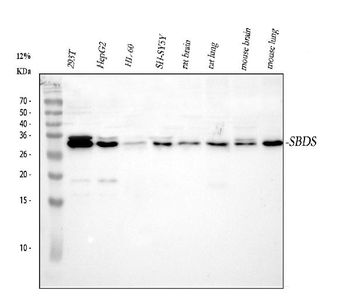 SBDS Rabbit Polyclonal Antibody