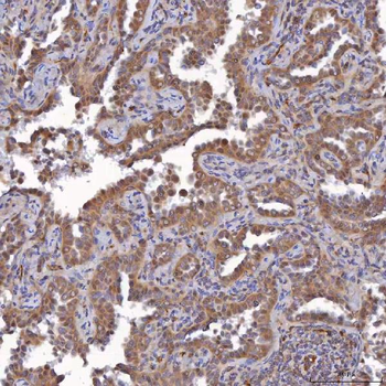 SAV1 Rabbit Polyclonal Antibody