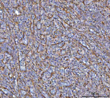 SAV1 Rabbit Polyclonal Antibody
