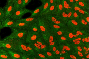 SART3 Rabbit Polyclonal Antibody