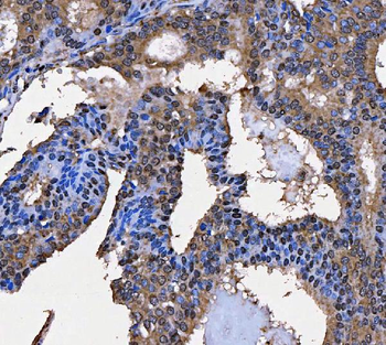 SART3 Rabbit Polyclonal Antibody