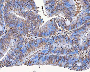 SART3 Rabbit Polyclonal Antibody