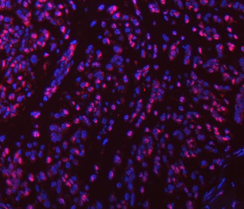 SART1 Rabbit Polyclonal Antibody