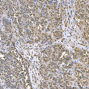 SART1 Rabbit Polyclonal Antibody