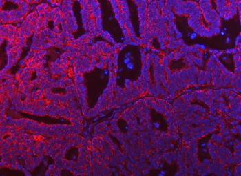 SARS2 Rabbit Polyclonal Antibody