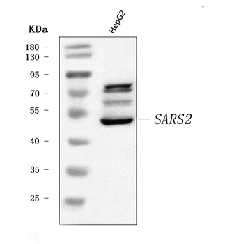 SARS2 Rabbit Polyclonal Antibody