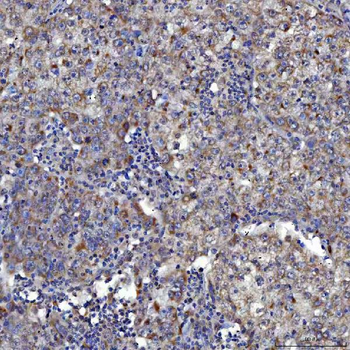 SARS2 Rabbit Polyclonal Antibody