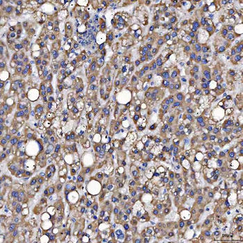 SARS2 Rabbit Polyclonal Antibody