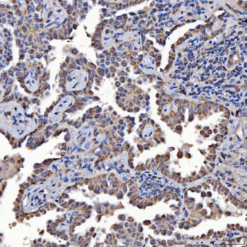 SARS2 Rabbit Polyclonal Antibody