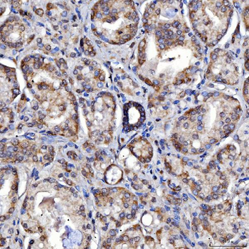 SARS2 Rabbit Polyclonal Antibody