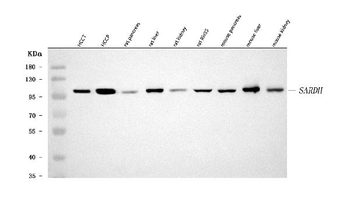SARDH Rabbit Polyclonal Antibody