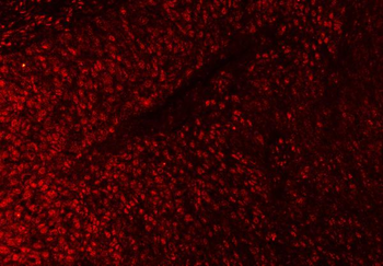 SAP18 Rabbit Polyclonal Antibody