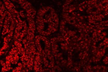 SAP18 Rabbit Polyclonal Antibody