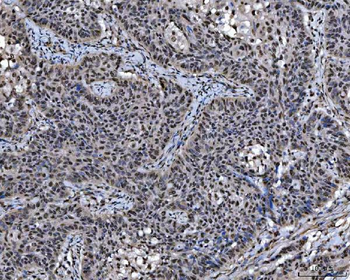 SAP18 Rabbit Polyclonal Antibody