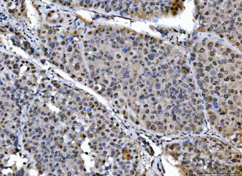 SAP18 Rabbit Polyclonal Antibody