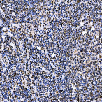 SAE1 Antibody